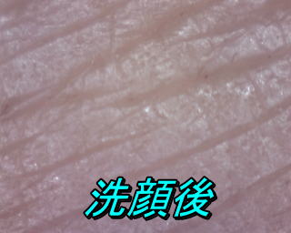 クレンジングjブラシ使用後の皮膚
