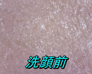 洗顔前